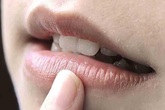 4 dấu hiệu bất thường trên miệng nhận biết có thể bạn đang mắc bệnh tim, cần chủ động đi khám sớm 4 dấu hiệu bất thường trên miệng nhận biết có thể bạn đang mắc bệnh tim, cần chủ động đi khám sớm