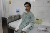Qua cơn nguy kịch, người mẹ đơn thân nghèo bị bỏng nặng cảm ơn các nhà hảo tâm Qua cơn nguy kịch, người mẹ đơn thân nghèo bị bỏng nặng cảm ơn các nhà hảo tâm