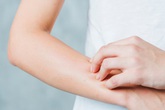 Điều trị viêm mao mạch dị ứng Điều trị viêm mao mạch dị ứng