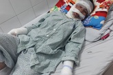 Xót xa mẹ đơn thân nghèo bị bỏng nặng xin về nhà vì không có tiền điều trị Xót xa mẹ đơn thân nghèo bị bỏng nặng xin về nhà vì không có tiền điều trị