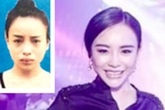 Phẫu thuật thành hot girl, hot boy trốn nã vẫn không thoát Phẫu thuật thành hot girl, hot boy trốn nã vẫn không thoát
