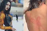 Bạn gái tố 'Ngũ A Ca' Khuất Sở Tiêu bạo dâm Bạn gái tố 'Ngũ A Ca' Khuất Sở Tiêu bạo dâm