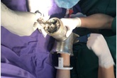 Bất cẩn trong lúc xay thịt, người phụ nữ bị cuốn cả bàn tay vào máy Bất cẩn trong lúc xay thịt, người phụ nữ bị cuốn cả bàn tay vào máy