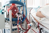Ca tử vong do xơ gan giai đoạn cuối ở Hà Nam không phải do COVID-19 Ca tử vong do xơ gan giai đoạn cuối ở Hà Nam không phải do COVID-19
