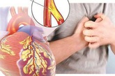 Bệnh nhân tim mạch cần lưu ý những điều này để sống khoẻ trong đại dịch COVID-19 Bệnh nhân tim mạch cần lưu ý những điều này để sống khoẻ trong đại dịch COVID-19