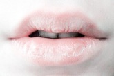 Có 7 dấu hiệu bất thường trên môi cảnh báo sức khỏe không tốt, mọi người nên đi khám ngay Có 7 dấu hiệu bất thường trên môi cảnh báo sức khỏe không tốt, mọi người nên đi khám ngay