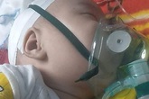Bé trai hơn 4 tháng nguy kịch sự sống vì teo thực quản khi bố mẹ quá nghèo Bé trai hơn 4 tháng nguy kịch sự sống vì teo thực quản khi bố mẹ quá nghèo