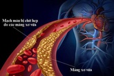Bí quyết 2 trong 1 vừa giảm đường huyết vừa giảm mỡ máu từ nghiên cứu quốc tế Bí quyết 2 trong 1 vừa giảm đường huyết vừa giảm mỡ máu từ nghiên cứu quốc tế