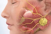 Cảnh báo 6 bệnh ung thư di truyền, nếu gia đình có 1 người mắc thì người thân cần khám sớm Cảnh báo 6 bệnh ung thư di truyền, nếu gia đình có 1 người mắc thì người thân cần khám sớm