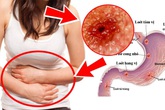 Trước và sau khi ngủ không làm điều này bạn sẽ đối diện nguy cơ ung thư dạ dày và cổ họng cực cao Trước và sau khi ngủ không làm điều này bạn sẽ đối diện nguy cơ ung thư dạ dày và cổ họng cực cao