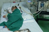 Chọc tổ ong vò vẽ, bé 4 tuổi bị đốt hơn 80 mũi phải đi cấp cứu Chọc tổ ong vò vẽ, bé 4 tuổi bị đốt hơn 80 mũi phải đi cấp cứu