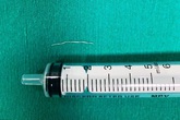 Sợi inox trong cổ họng bé 8 tháng tuổi Sợi inox trong cổ họng bé 8 tháng tuổi
