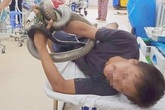 Bệnh nhân bị rắn hổ mang cắn đã qua cơn nguy kịch Bệnh nhân bị rắn hổ mang cắn đã qua cơn nguy kịch