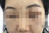 Hai phụ nữ nhập viện sau khi tiêm tế bào gốc Hai phụ nữ nhập viện sau khi tiêm tế bào gốc