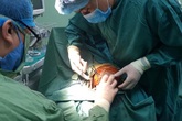Kinh hoàng: Cháu bé 5 tuổi bị chó nhà cắn rách nát mặt, đầu Kinh hoàng: Cháu bé 5 tuổi bị chó nhà cắn rách nát mặt, đầu