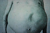 Chuyện kỳ lạ về người đàn ông bị táo bón bẩm sinh, chết khi cố đi đại tiện và ruột già được trưng bày trong bảo tàng Mỹ gây "sởn da gà" Chuyện kỳ lạ về người đàn ông bị táo bón bẩm sinh, chết khi cố đi đại tiện và ruột già được trưng bày trong bảo tàng Mỹ gây "sởn da gà"