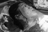 Hẹn đánh ghen, một phụ nữ bị đâm rách mặt Hẹn đánh ghen, một phụ nữ bị đâm rách mặt
