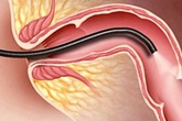 Bác sĩ khuyến cáo: Những dấu hiệu cảnh báo có thể là ung thư, nên chú ý đi khám sớm Bác sĩ khuyến cáo: Những dấu hiệu cảnh báo có thể là ung thư, nên chú ý đi khám sớm