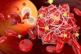 Uống nước vào 4 thời điểm này còn tốt hơn trăm viên thuốc bổ, ngăn ngừa tắc mạch máu Uống nước vào 4 thời điểm này còn tốt hơn trăm viên thuốc bổ, ngăn ngừa tắc mạch máu