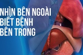 BS hướng dẫn cách "nhìn ngoài thấy trong" để xem bạn đang khỏe hay có bệnh: Rất hữu ích BS hướng dẫn cách "nhìn ngoài thấy trong" để xem bạn đang khỏe hay có bệnh: Rất hữu ích