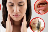 Thiếu vitamin có nguy hiểm? Thiếu vitamin có nguy hiểm?