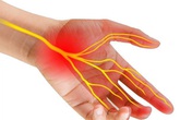 Chữa trị hội chứng ống cổ tay thế nào? Chữa trị hội chứng ống cổ tay thế nào?
