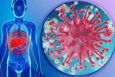 Virus nào gây viêm gan? Virus nào gây viêm gan?