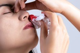 Bị chảy máu mũi do đâu? Bị chảy máu mũi do đâu?
