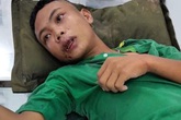 Khoảng 100 người tấn công lực lượng bắt thuốc lá lậu Khoảng 100 người tấn công lực lượng bắt thuốc lá lậu