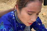 Đồng nghiệp thương xót “bà mối” Cát Tường bị thương trên trường quay Đồng nghiệp thương xót “bà mối” Cát Tường bị thương trên trường quay