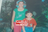 Hành trình chữa bệnh khốn khổ của người phụ nữ có mái tóc “sư tử” Hành trình chữa bệnh khốn khổ của người phụ nữ có mái tóc “sư tử”