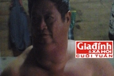 Căn bệnh bí hiểm của người đàn ông có bộ ngực khổng lồ Căn bệnh bí hiểm của người đàn ông có bộ ngực khổng lồ