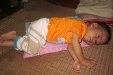 Ngằn ngặt tiếng khóc của bé 17 tháng tuổi bị u hạch Ngằn ngặt tiếng khóc của bé 17 tháng tuổi bị u hạch