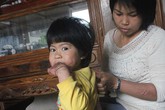 Hy vọng sống ùa đến với cô bé cơ thể cháy đen Hy vọng sống ùa đến với cô bé cơ thể cháy đen