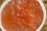 Những thực phẩm đơn giản chống ung thư gan Những thực phẩm đơn giản chống ung thư gan
