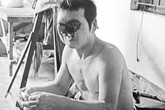 Mang 'mặt quỷ' vì phá mụn ruồi Mang 'mặt quỷ' vì phá mụn ruồi