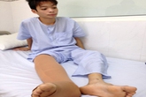 Chữa thành công bệnh chân voi cho cậu học trò giỏi Chữa thành công bệnh chân voi cho cậu học trò giỏi