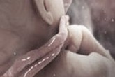 Thai bị dây rốn quấn cổ có nguy hiểm? Thai bị dây rốn quấn cổ có nguy hiểm?