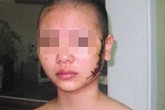 Tòa Vũng Tàu 'sốc' vì vụ thiếu nữ bị xăm rết phải điều tra lại Tòa Vũng Tàu 'sốc' vì vụ thiếu nữ bị xăm rết phải điều tra lại