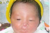 Bé trai sơ sinh không có tay chân Bé trai sơ sinh không có tay chân