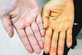 Những kinh nghiệm quý cho lá gan khỏe suốt mùa đông Những kinh nghiệm quý cho lá gan khỏe suốt mùa đông