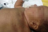 Bé trai hai tháng tuổi bị bạo hành dã man Bé trai hai tháng tuổi bị bạo hành dã man