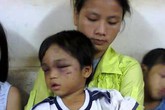 Cháu bé 3 tuổi bị bạo hành được mẹ đưa đi trốn? Cháu bé 3 tuổi bị bạo hành được mẹ đưa đi trốn?