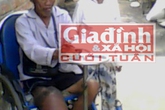 Đời cơ cực của người đàn ông hơn 20 năm góp tiền nhờ bác sỹ… cắt chân mình Đời cơ cực của người đàn ông hơn 20 năm góp tiền nhờ bác sỹ… cắt chân mình
