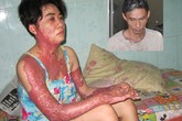 Vụ chồng tạt xăng đốt vợ vì máu đỏ đen: Tâm sự đắng lòng của người vợ Vụ chồng tạt xăng đốt vợ vì máu đỏ đen: Tâm sự đắng lòng của người vợ