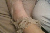 Phá hủy nhan sắc vì tắm trắng giá bèo Phá hủy nhan sắc vì tắm trắng giá bèo