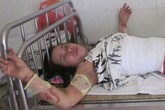 Tránh nguy hiểm khi sử dụng bếp cồn Tránh nguy hiểm khi sử dụng bếp cồn