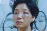 Nỗi lòng người vợ bị chồng “say là đánh” Nỗi lòng người vợ bị chồng “say là đánh”
