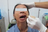 Người phụ nữ 30 năm không há miệng đã phục hồi tốt Người phụ nữ 30 năm không há miệng đã phục hồi tốt