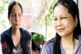 Cô gái “hóa bà lão” vẫn chưa trẻ lại Cô gái “hóa bà lão” vẫn chưa trẻ lại